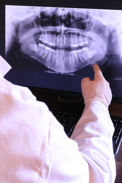 Best Emergency Denture Repair in Limon, CO