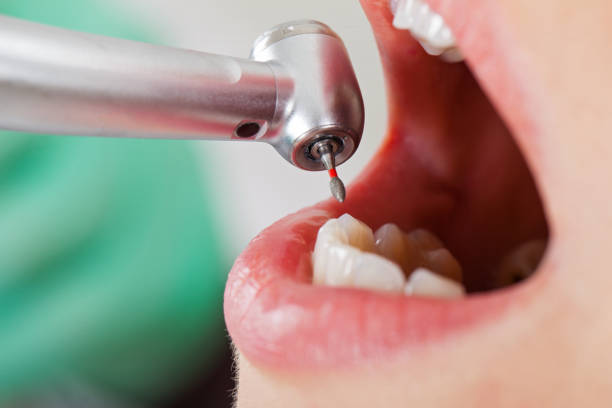 Best Weekend Emergency Dentist in Limon, CO